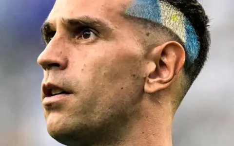Emiliano Martinez Tes Medis di Chelsea, Kontrak Sampai 2028